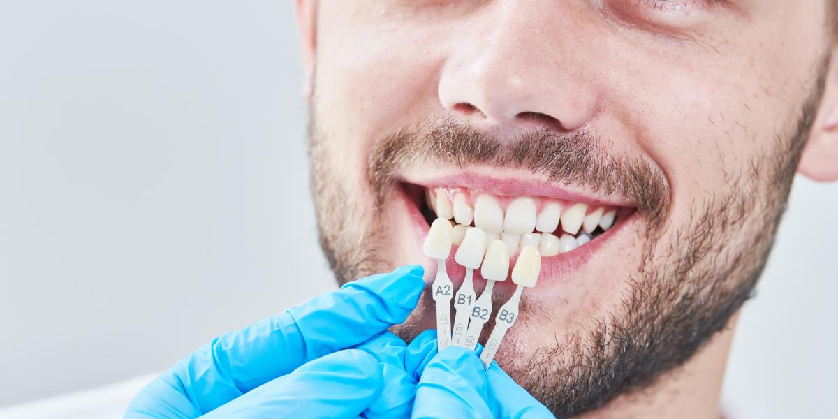 banner of Dental Implants: Wear The Smile You Want